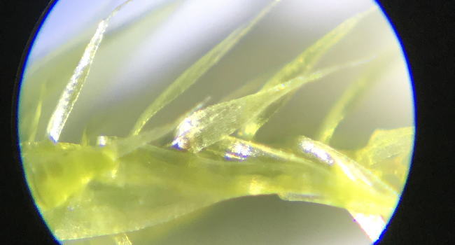 ハネヒツジゴケの顕微鏡写真