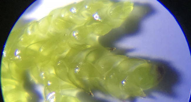 シノブゴケの顕微鏡写真